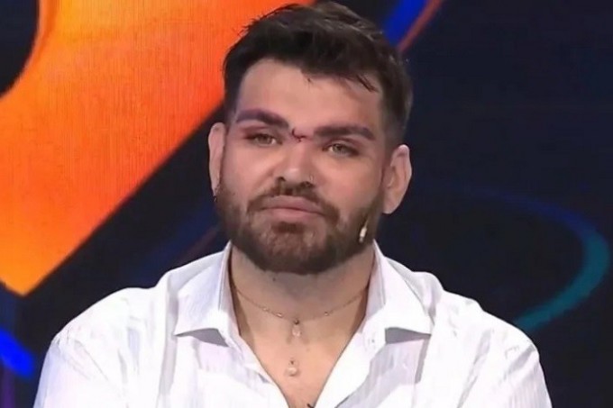 El duro momento de Fran Mariano: fue internado de urgencia y podrían amputarle un pie
