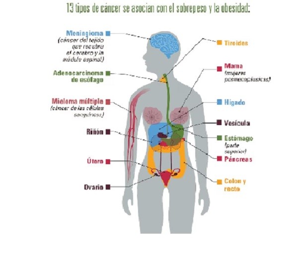 La obesidad y el cáncer